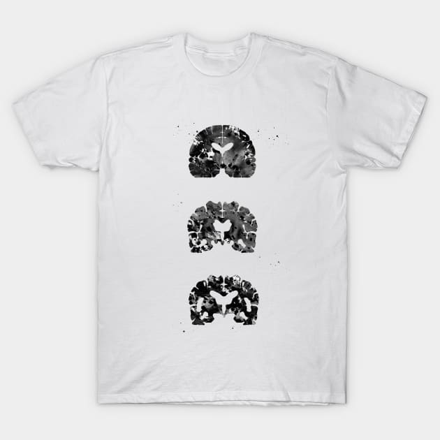 Alzheimer's Disease T-Shirt by erzebeth